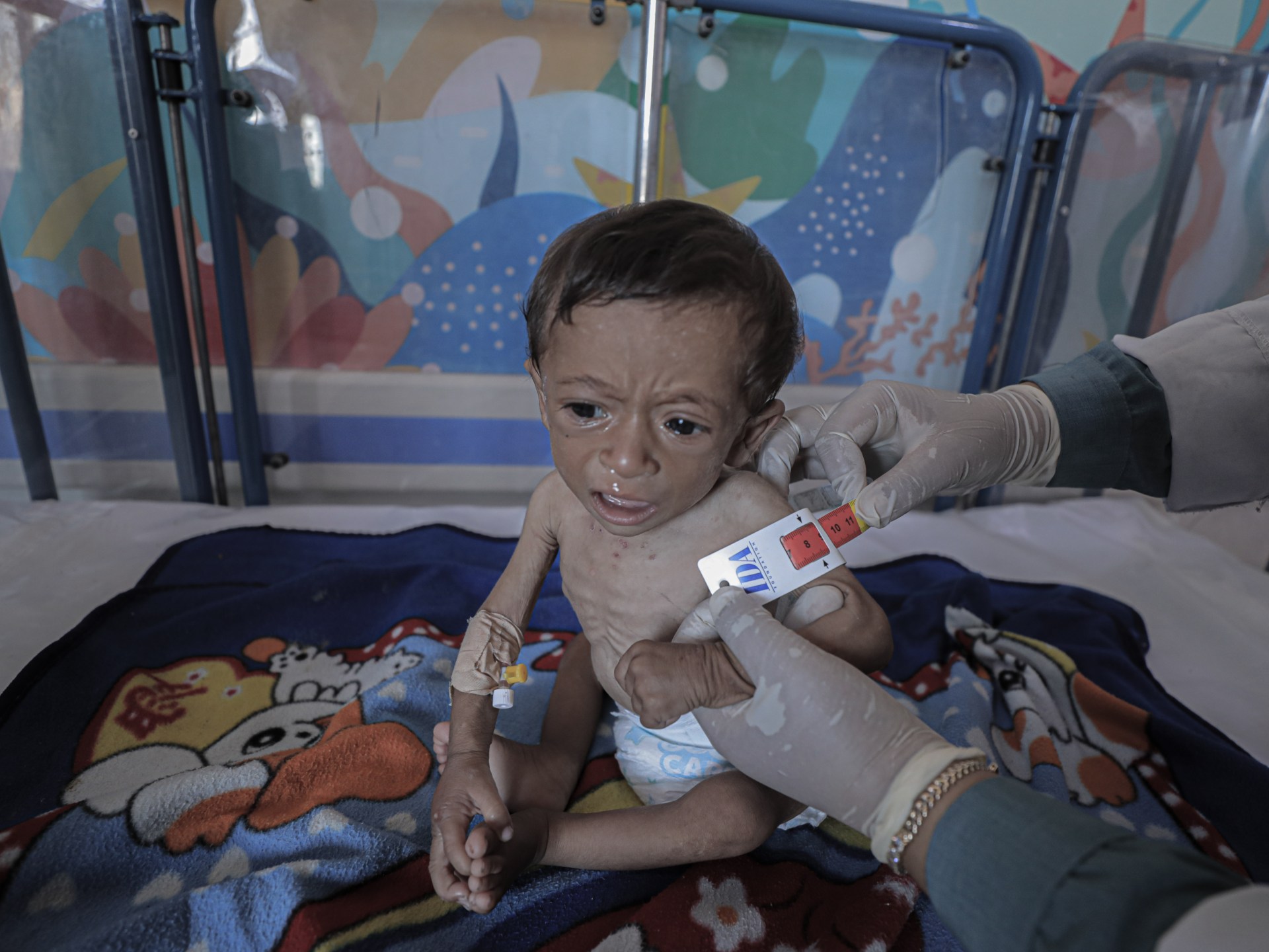 Israel starving Gaza: 266 dead from starvation, including 122 children | Israel-Palestine conflict News