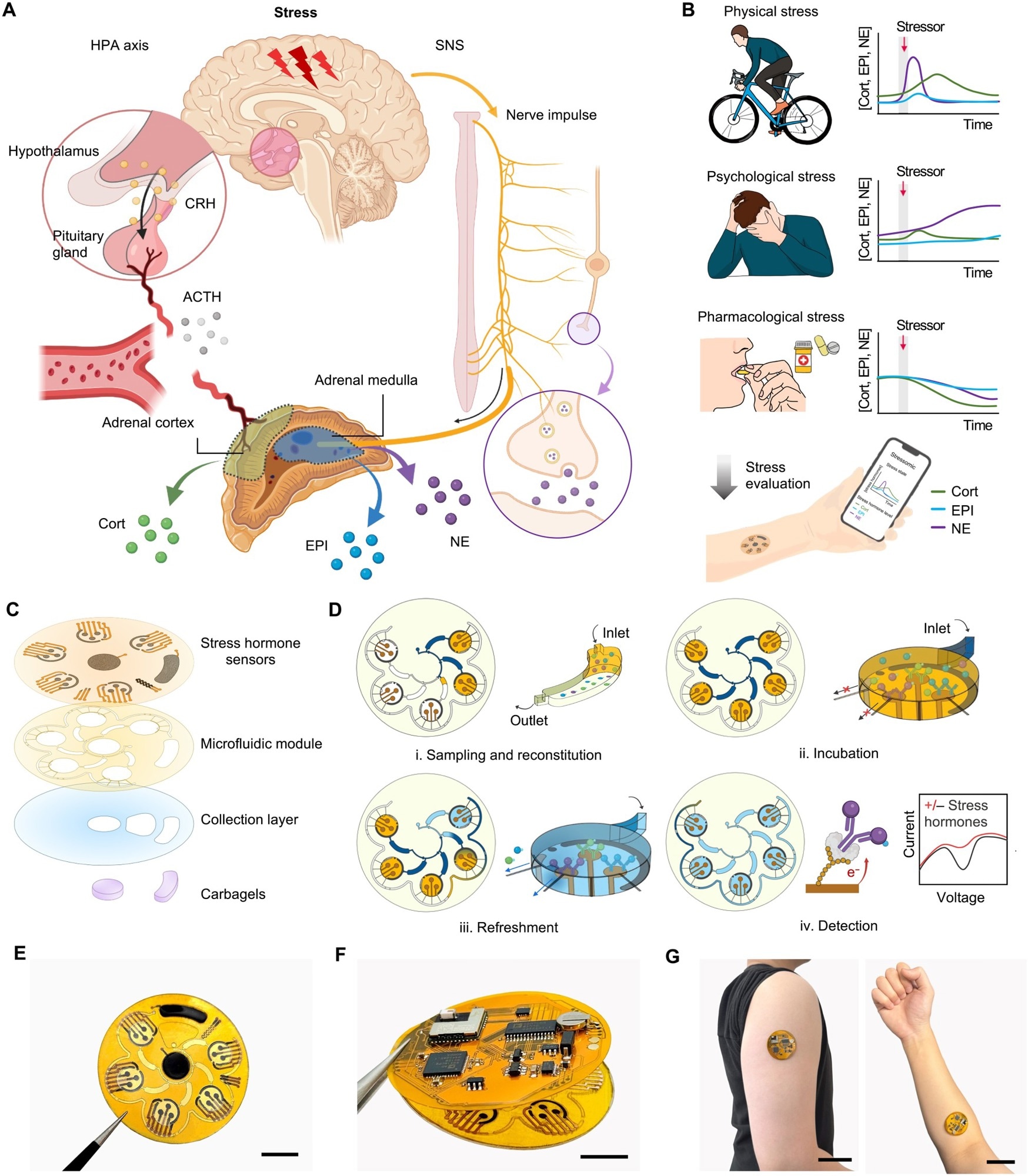 Overview of Stressomic, a multiplexed wearable stress hormone monitoring system. (A) Schematic illustration of the body’s stress response pathways. The HPA axis triggers cortisol (Cort) release via corticotropin-releasing hormone (CRH) and adrenocorticotropic hormone (ACTH), while the SNS stimulates the adrenal medulla to release epinephrine (EPI) and norepinephrine (NE) into the bloodstream and secrete NE at nerve terminals to regulate local tissue responses. (B) Representative profiles of Cort, EPI, and NE levels under physical stress (HIIT), emotional stress (IAPS), and after stress modulation (supplementation). These data illustrate example trends rather than continuous hormone dynamics. (C) Design of Stressomic, consisting of three hormone biosensors, a microfluidic module for automated sequential sweat sampling, reconstitution, and reagent delivery, a collection layer that facilitates sweat sampling and accumulation, and a pair of carbachol-loaded hydrogels for on-demand sweat induction. (D) Workflow of the microfluidic system for stress hormone detection: (i) Sweat fills reagent and detection chambers, reconstituting analytes in buffer with redox-labeled competitors; (ii) Analytes incubate and compete for binding at electrodes in detection chambers; (iii) Unbound molecules are flushed to preserve sensor accuracy during automated refresh cycles; (iv) Electrochemical detection quantifies hormones by measuring redox signals, enabling sensitive, real-time monitoring. (E to G) Photos of Stressomic, including the microfluidic sensor patch (E), fully integrated wireless system (F), and a system worn on the upper arm and forearm (G). Scale bars, 1 cm (E and F) and 5 cm (G).