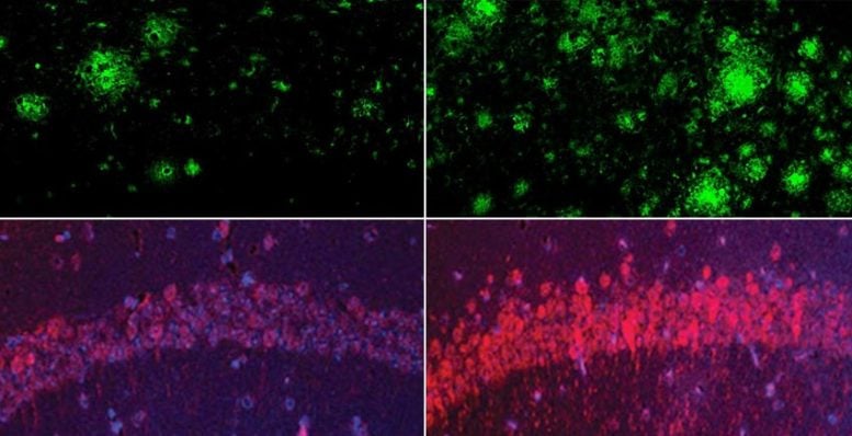 Lithium Deficiency vs. Normal Lithium Levels