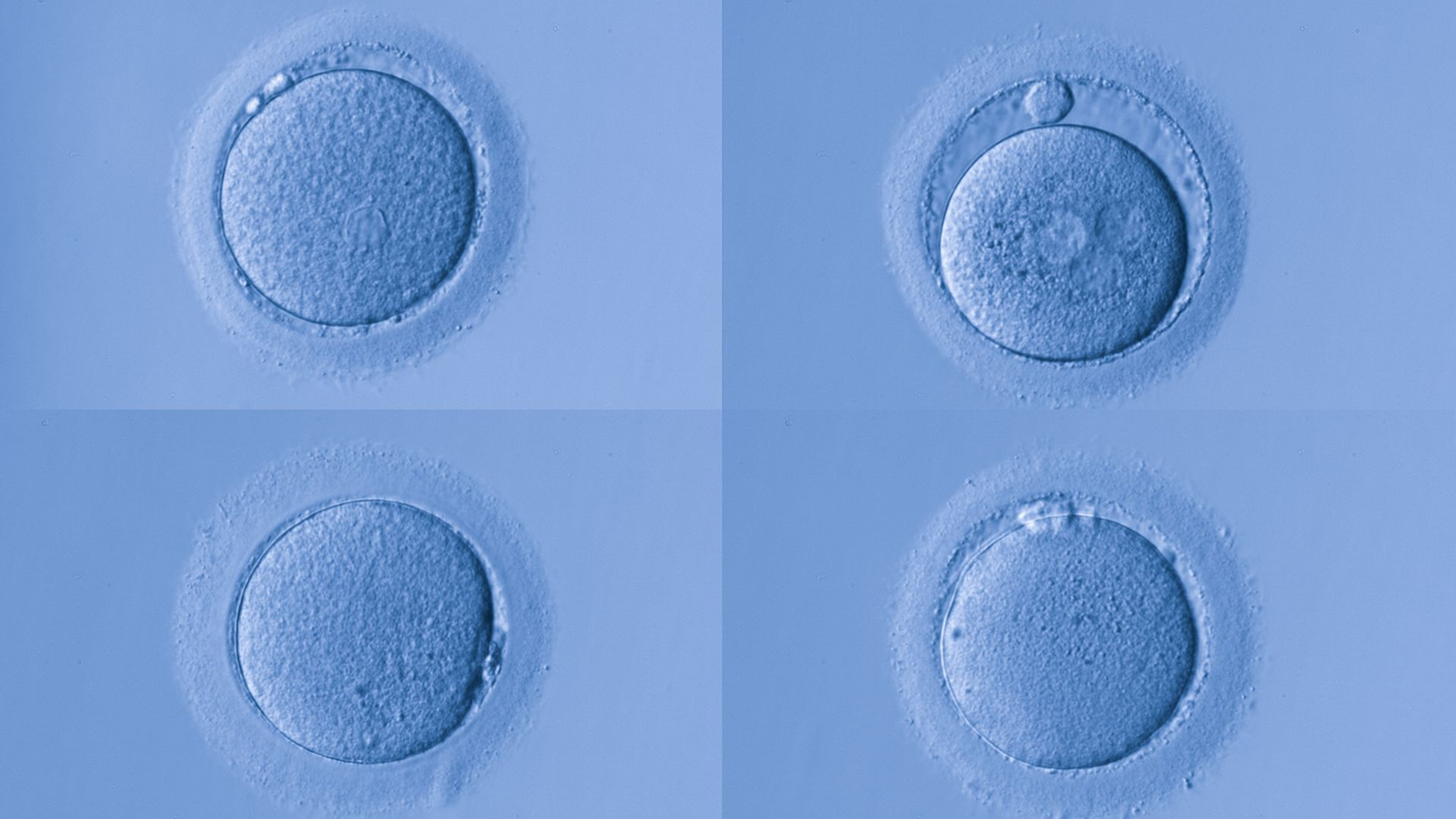 Human eggs have special protection against certain types of aging, study hints