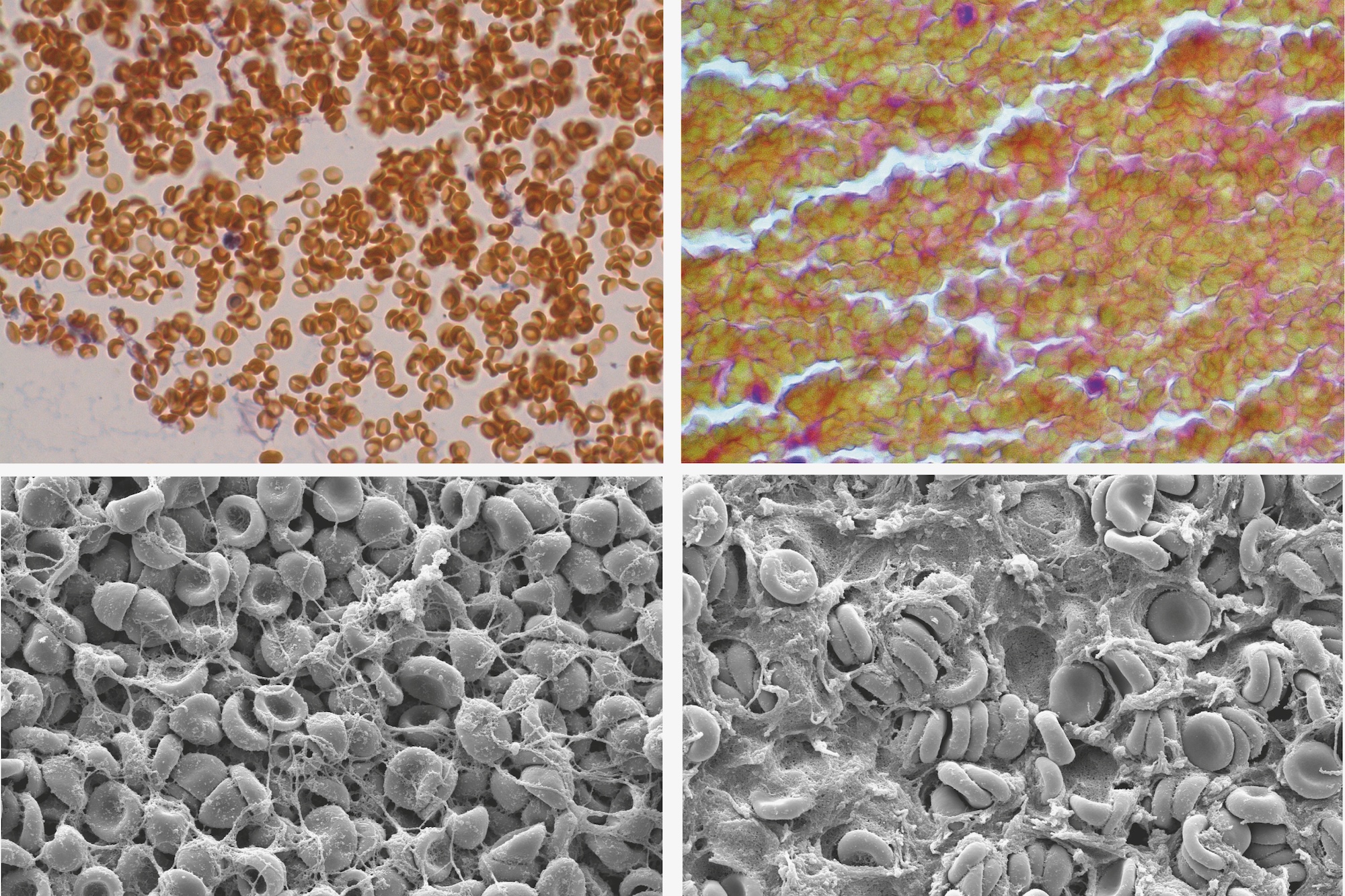 Centuries after discovery, red blood cells still hold surprises