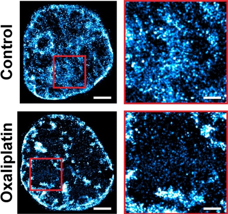Untreated Cancer Cells vs Chemotherapy Treated