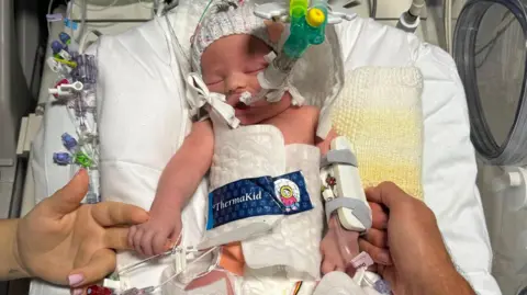 Olivia Dewar A newborn baby in a hospital cot. The baby is wearing a woollen hat and has tubes coming from her mouth and nose. She is holding onto a woman's hand on one side and a man's on the other.