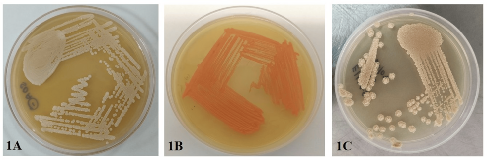 Spectrum of Fungal Infections in Continuous Ambulatory Peritoneal Dialysis: A 20-Year Retrospective Study From a Tertiary Care Center