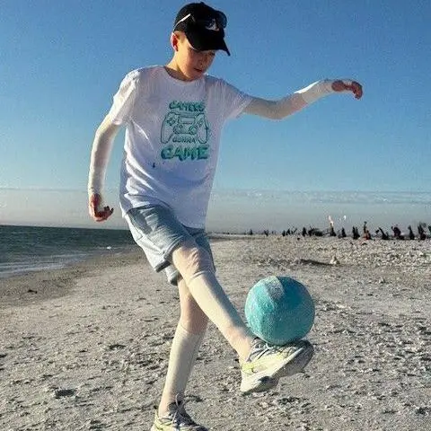 GOSH Gabrielius Misurenkovas playing football on a beach with bandages around his legs