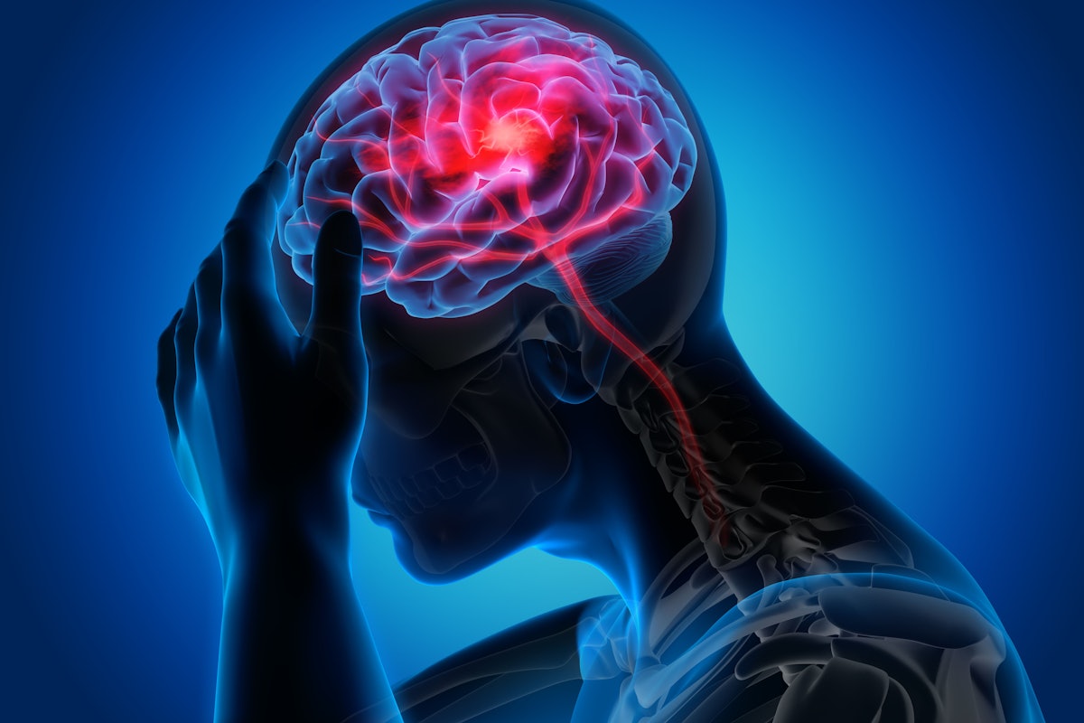 Researchers test ChatGPT-4 Turbo for radiology AI post-market monitoring