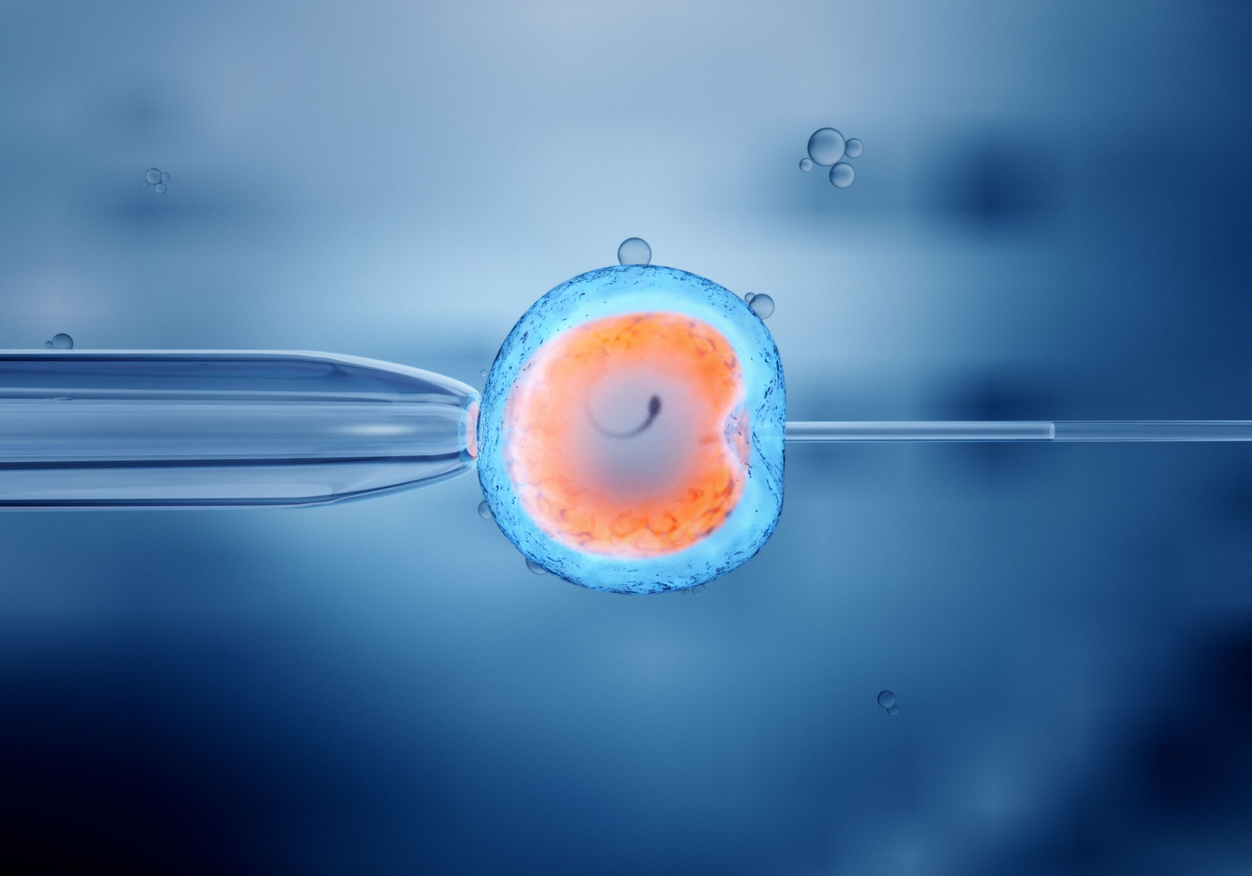 Weight Loss Could Aid IVF Fertility Outcomes in Women with Obesity