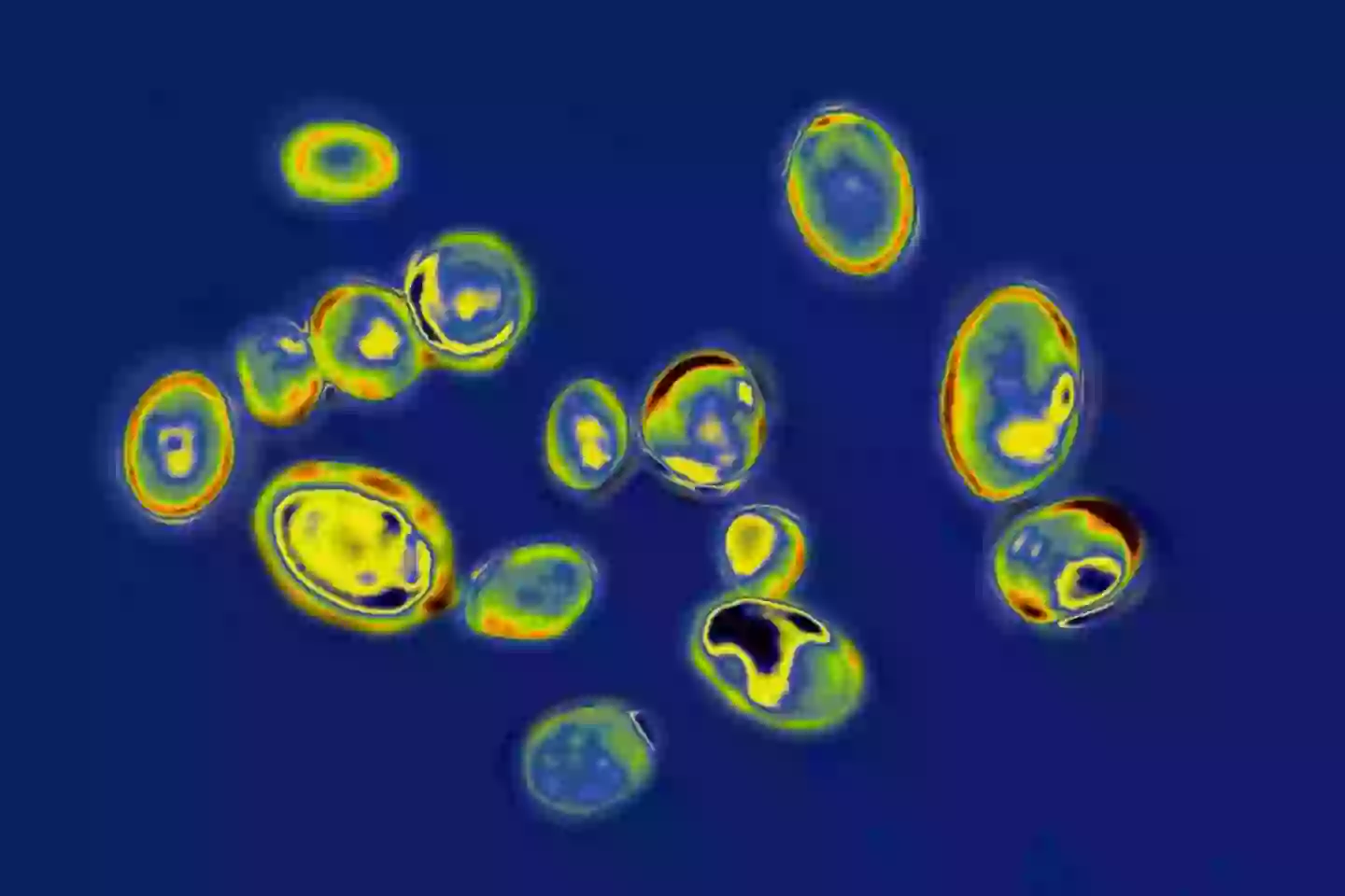 The Candida auris fungus can spread rapidly (BSIP/Education Images/Universal Images Group via Getty Images)