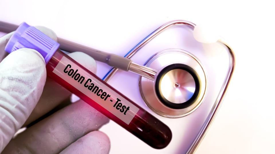 Early screening and timely removal of polyps play an important role in preventing colon cancer. (Shutterstock)
