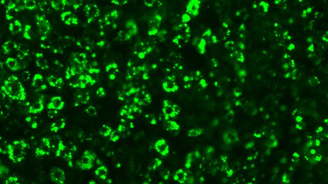 CRISPR Finds New Drug Targets for Obesity