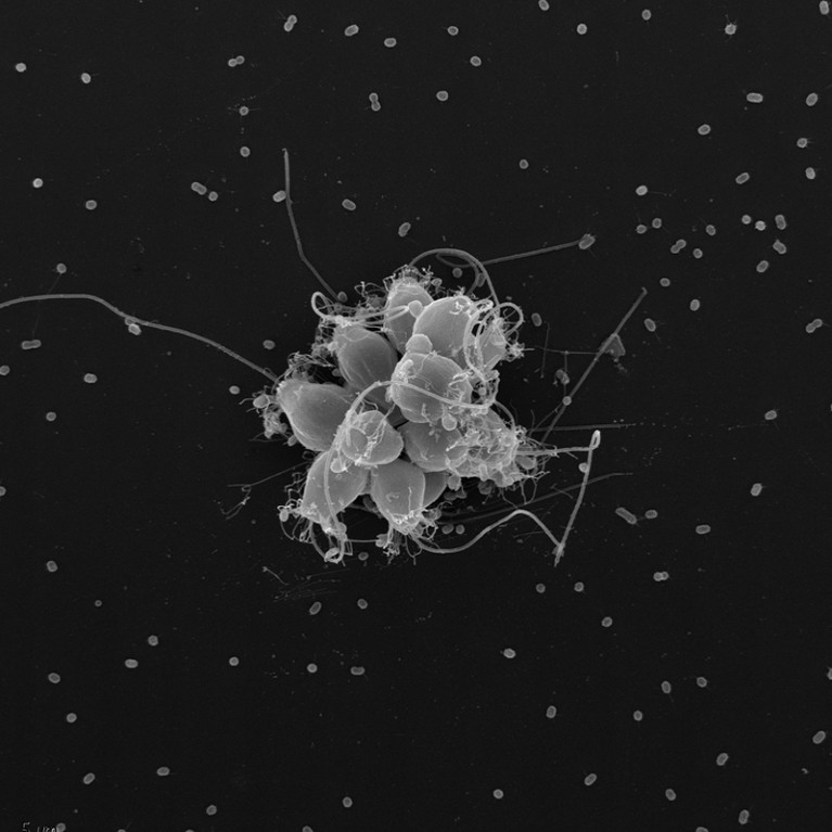 Scanning electron micrograph of cells that have clustered together to look like a flower