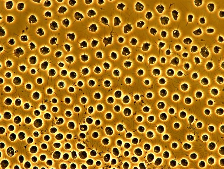 Colour micrograph of many black circular cells on a yellow background