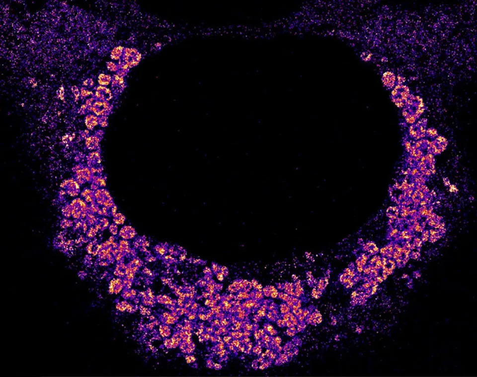 Image of how the Covid-19 virus hides from the cell’s immune system by wrapping itself inside double-membrane bubbles when replicating. The bubbles are seen as clumpy aggregates of the virus’s fluorescently labeled genetic material and the dark circle in the middle is the cell nucleus. - L. Andronov et al // Nature Communications 2024