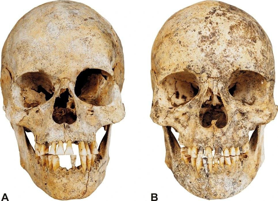 Reconstructions reveal faces of Neolithic sisters buried 6,000 years ago
