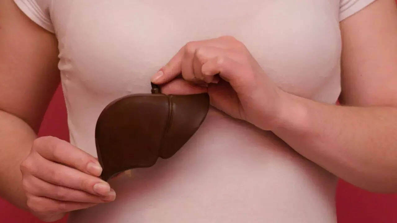 Fatty liver (3)