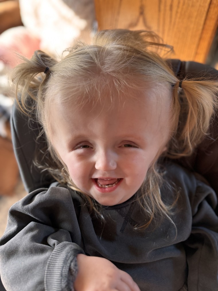 Doctors said their newborn would die within weeks. She's now 3 and thriving thanks to a 2nd opinion