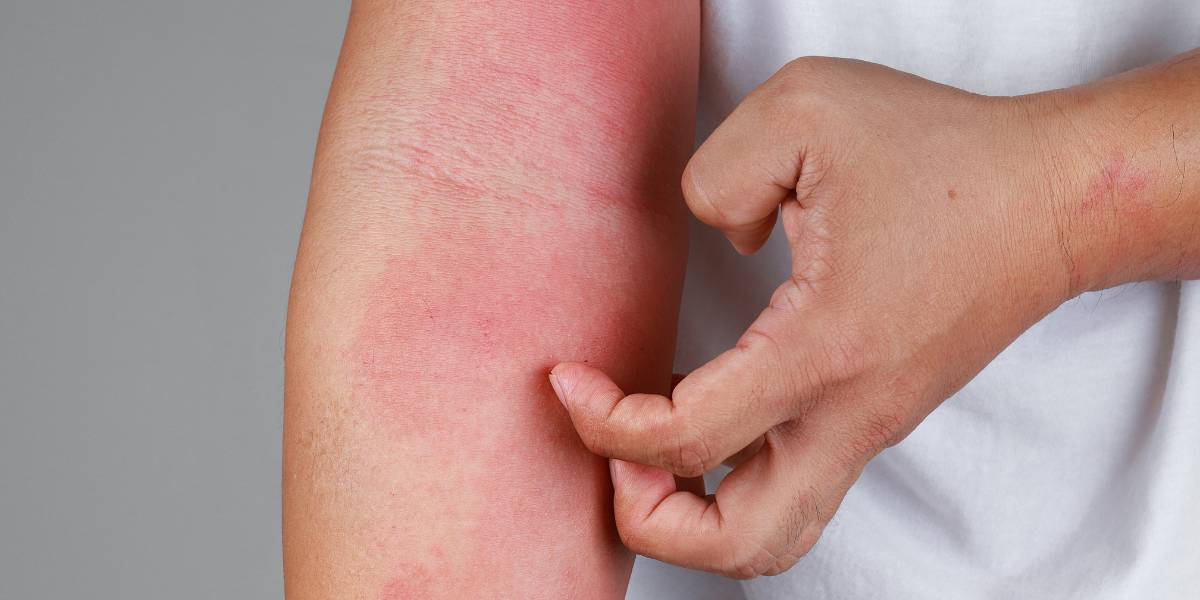 Increase in post-pandemic gut-brain disorders revealed in new research