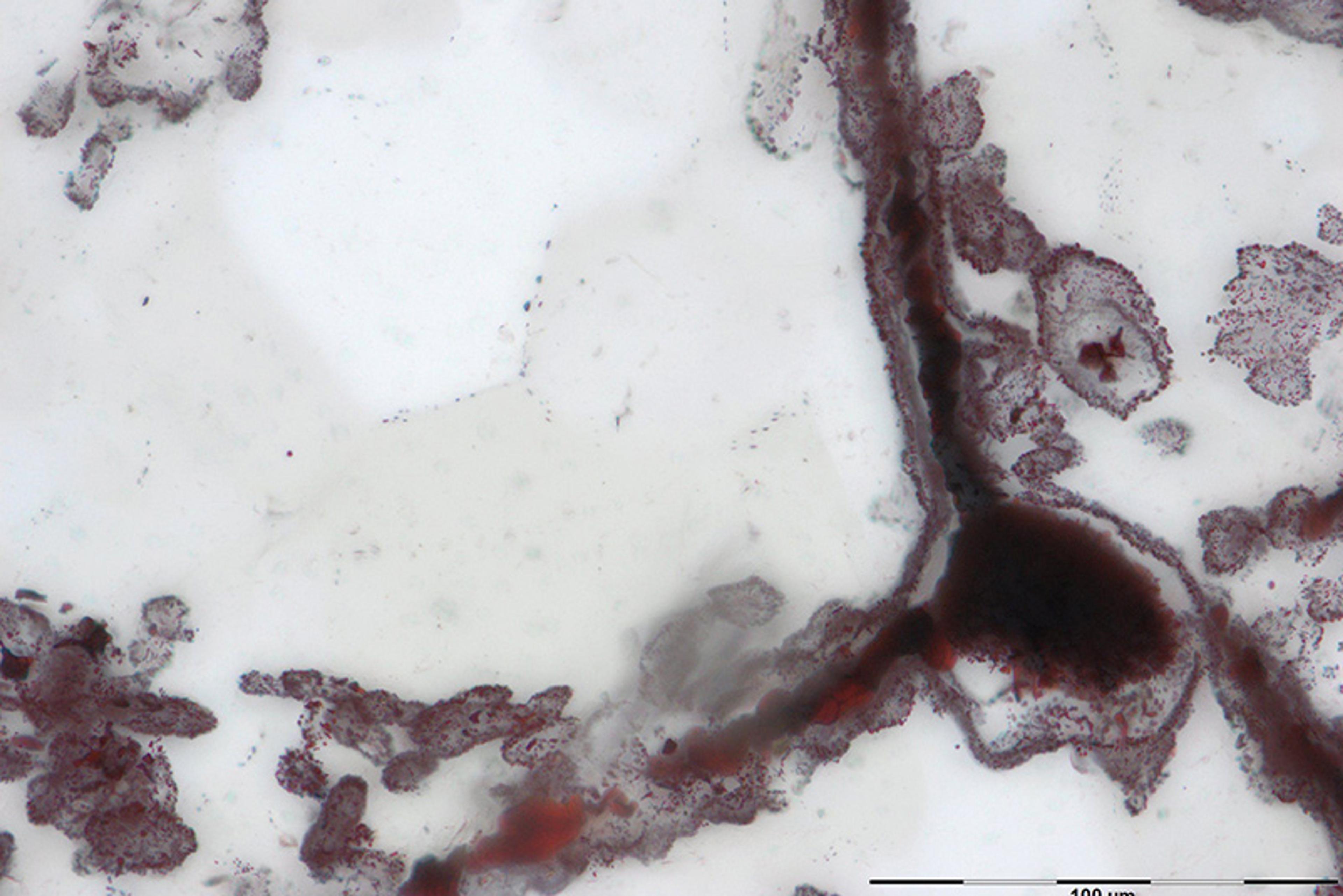 Microscope image showing red-brown mineral deposits on a white background with scale bar in micrometres.