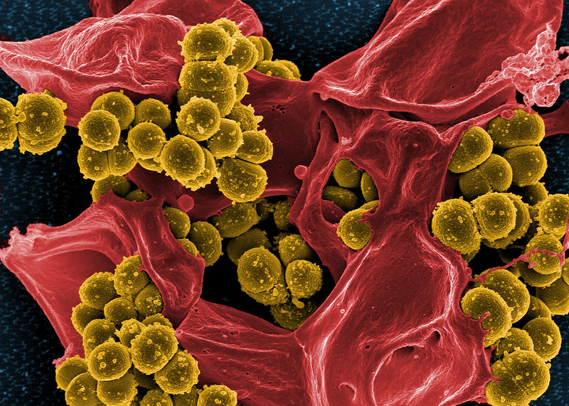 Two-dose therapy for S. aureus bloodstream infections on par with standard treatment
