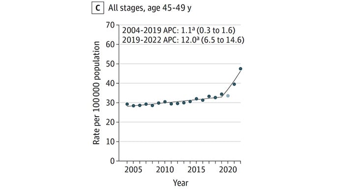 photo of Colorectal cancer screening