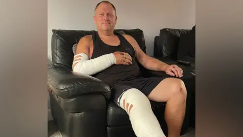 Danny Cockerill Danny sits on the black leather sofa smiling at the camera. He wears a black vest and shorts and his right forearm and leg are fully bandaged. You can see scabs where his hands and knees were hurt.