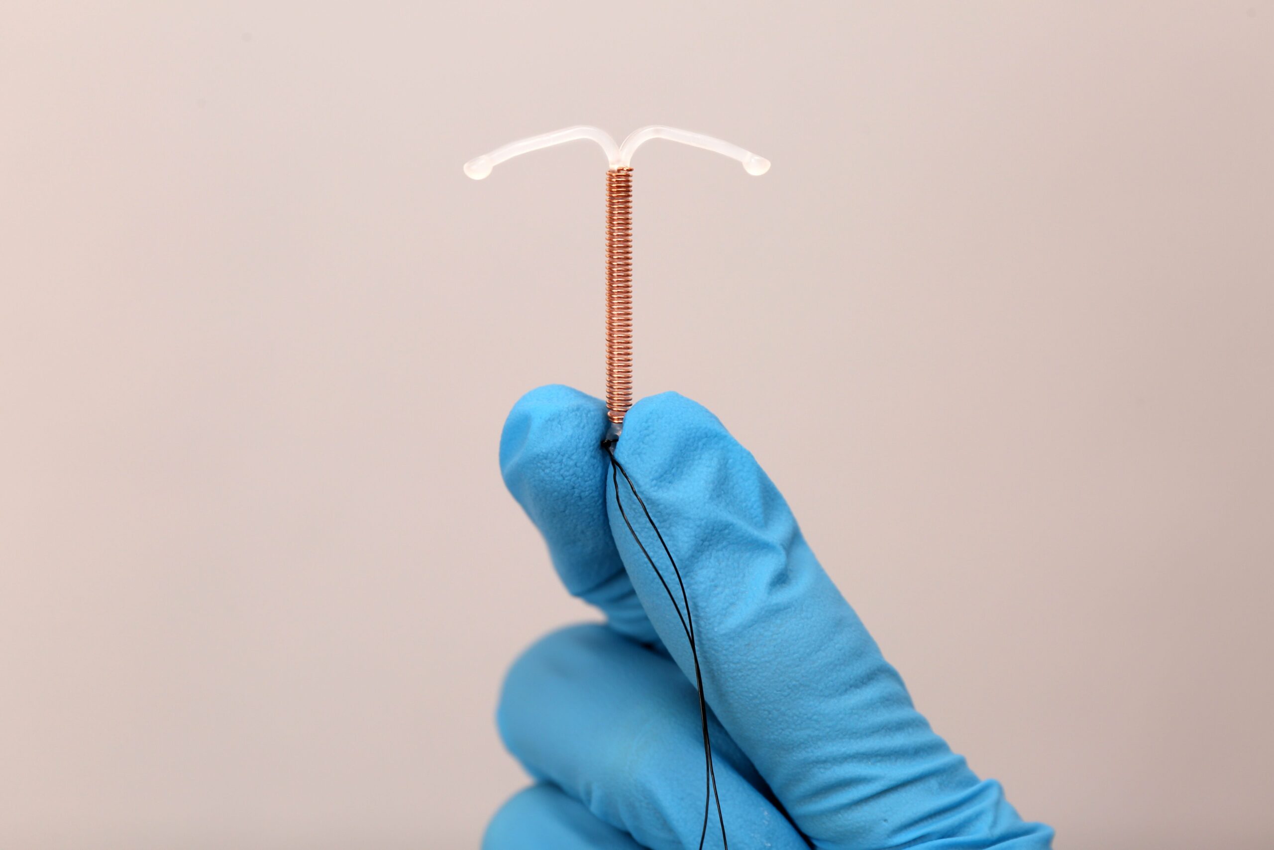 Immediate postpartum IUDs increase use but raise expulsion risk