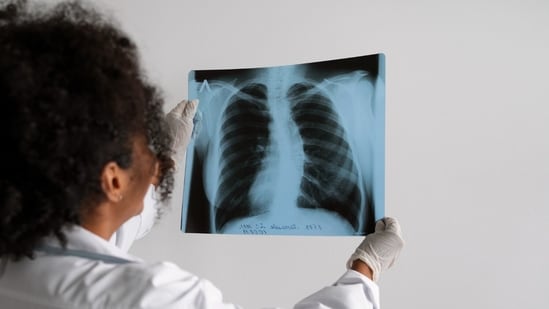Passive smoking can increase lung cancer risk.(Freepik)