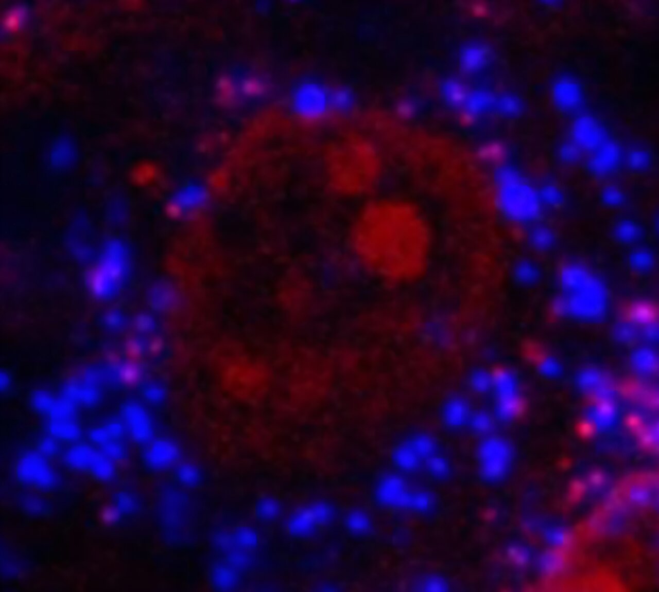 Blue highlighted microplastics crammed into a bone cell