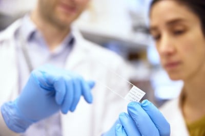 Mount Sinai Receives $8 Million from DataPhilanthropy to Accelerate Drug Discovery for CADASIL and Related Brain Disorders