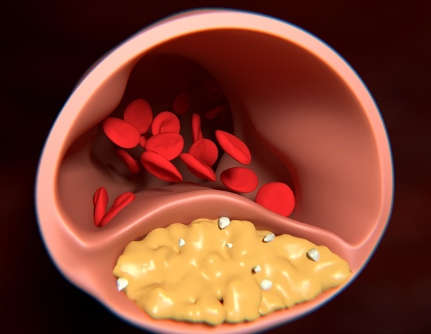 Heparanase 2 emerges as key protector of blood vessel integrity