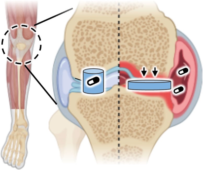 Artificial Cartilage Graphic