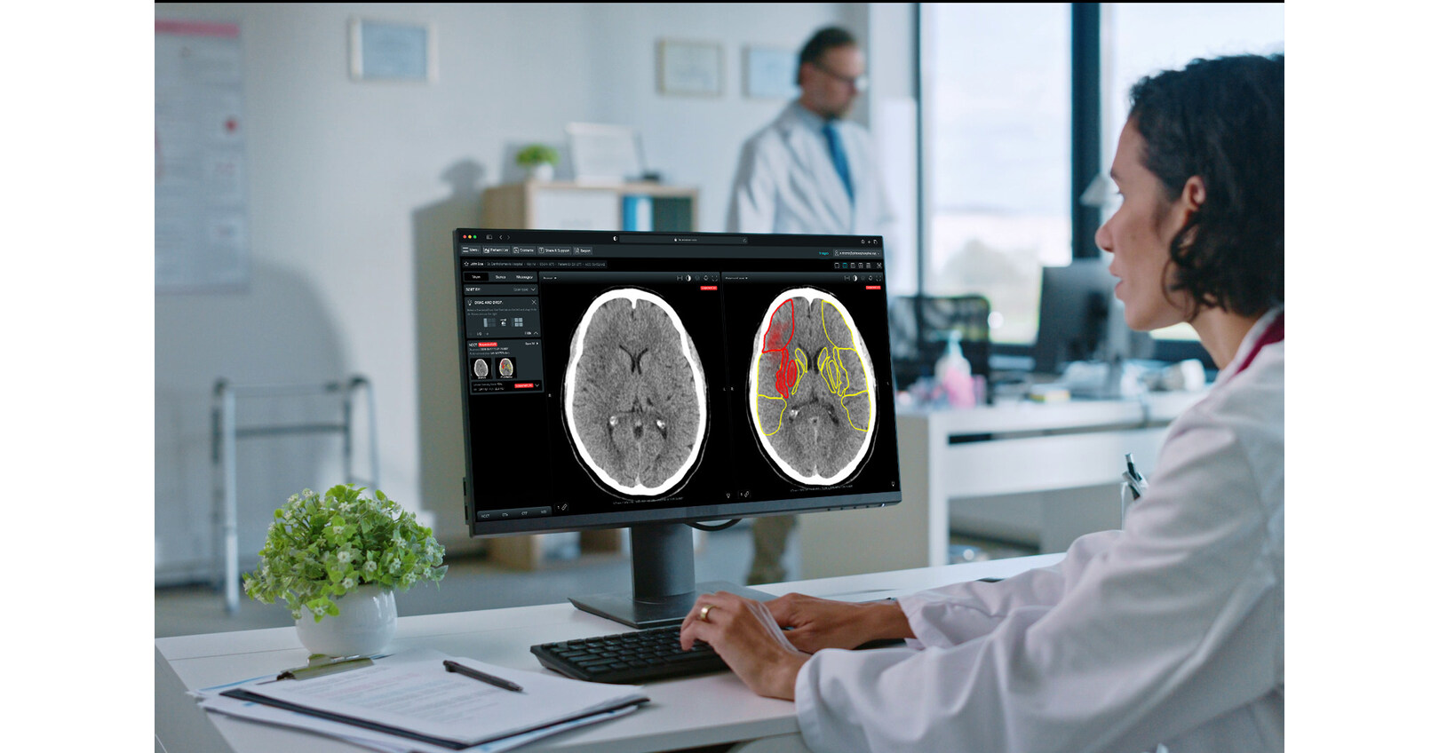 Brainomix Stroke AI Software Hailed as ῾Revolutionary,’ Helping More Patients Fully Recover