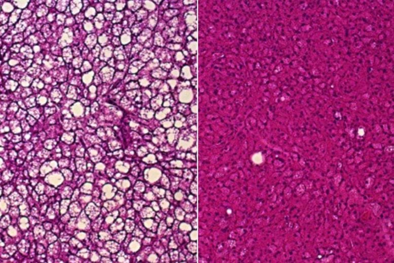 Brown Fat Tissue Sections Showing Fat Accumulation in Mice