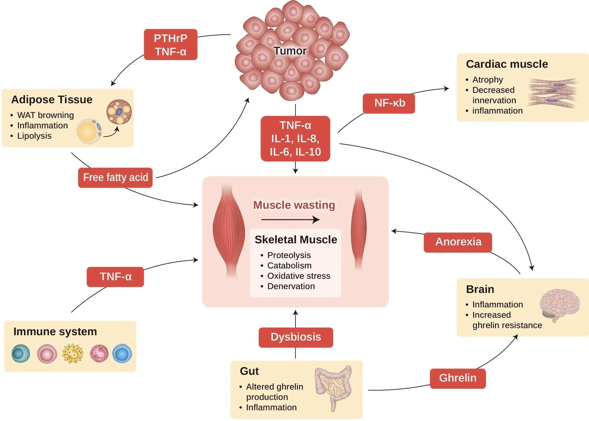 Cancer cachexia as a multi-organ syndrome. This scheme illustrates the interaction of major organs commonly associated with and affected by cachexia. Cancer cachexia that happens in the muscle (center) is dependent on the alterations in other organs, such as adipose tissue, brain, gut, cardiac muscle, and immune cells. Cachexia-inducing tumors secrete many factors, such as cytokines, PTHrP, and other mediators, to induce muscle wasting directly, as well as affecting other organs such as the brain, cardiac muscle, gut, and adipocyte tissue, which aggravates cachexia syndrome. WAT, white adipocyte tissue; PTHrP, parathyroid hormone-related protein; TNF-α, tumor necrosis factor-α; IL-1, interleukin-1; IL-6, interleukin 6; IL-8, interleukin-8; IL-10, interleukin 10; and NF-kB, nuclear factor kappa-light-chain-enhancer of activated B cells.3
