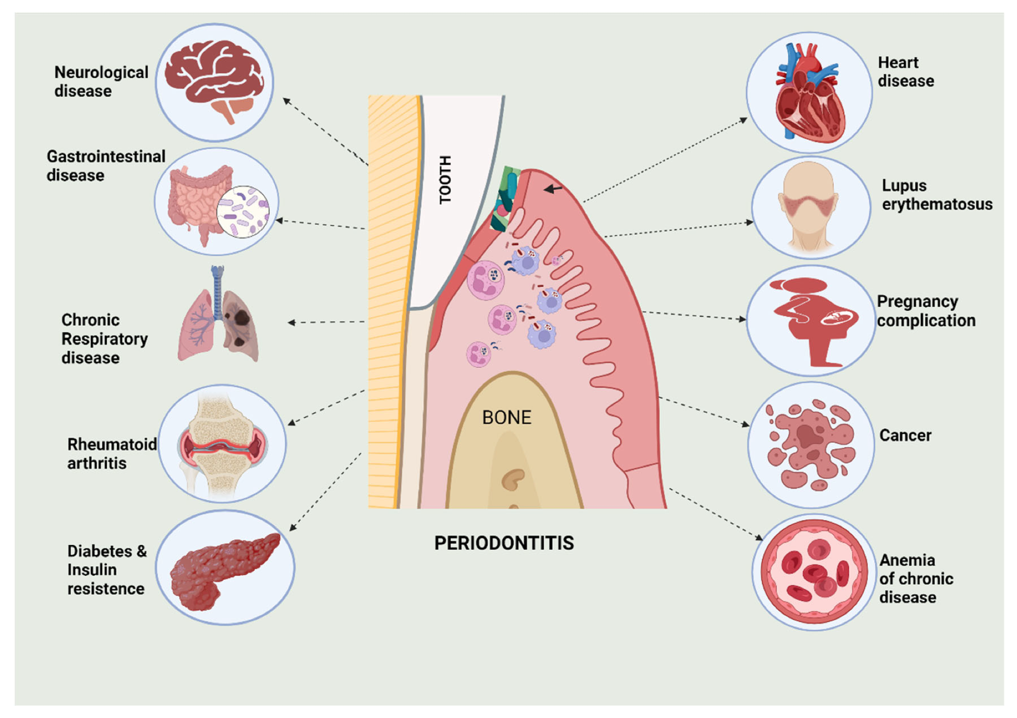 Representation of diverse systemic diseases and their relationship with periodontitis.2