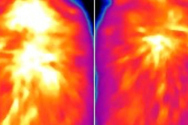 Infrared Images of Brown Fat Heat Production in Mice
