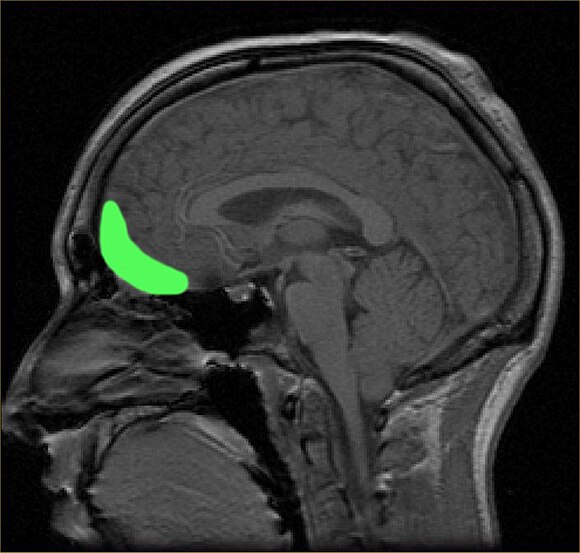 Orbitofrontal