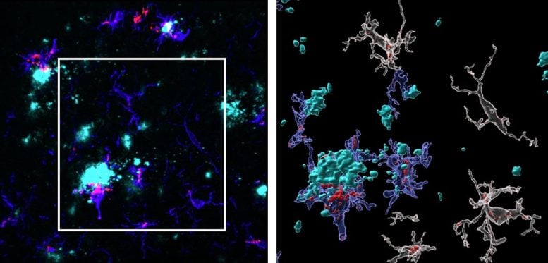 Microglia With TSPO Clustering Around Plaques in Brain Image