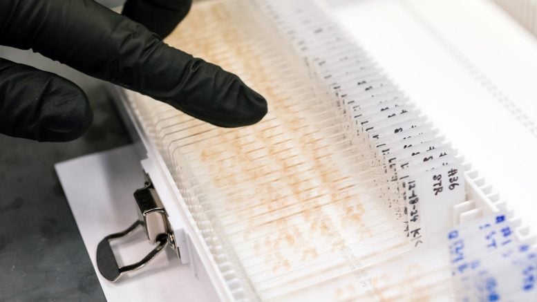 Neurons Parkinsons Disease Brain Slides
