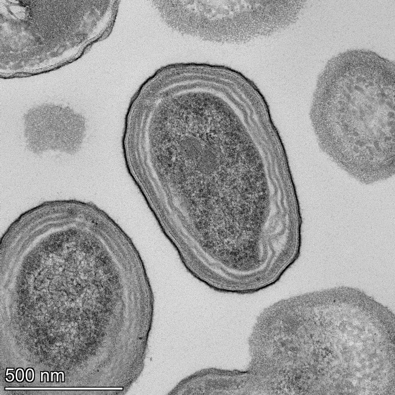 Prochlorococcus cells