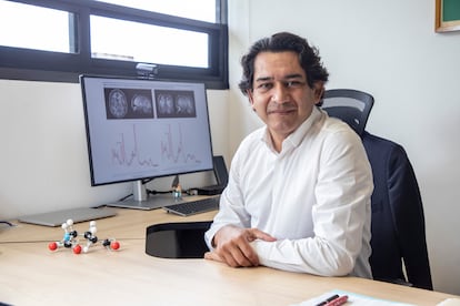 El Dr. Camilo de la Fuente-Sandoval, neurocientífico e investigador. mexicano en el Instituto Nacional de Neurología y Neurocirugía Manuel Velasco Suárez en Ciudad de México el 15 de agosto del 2025.