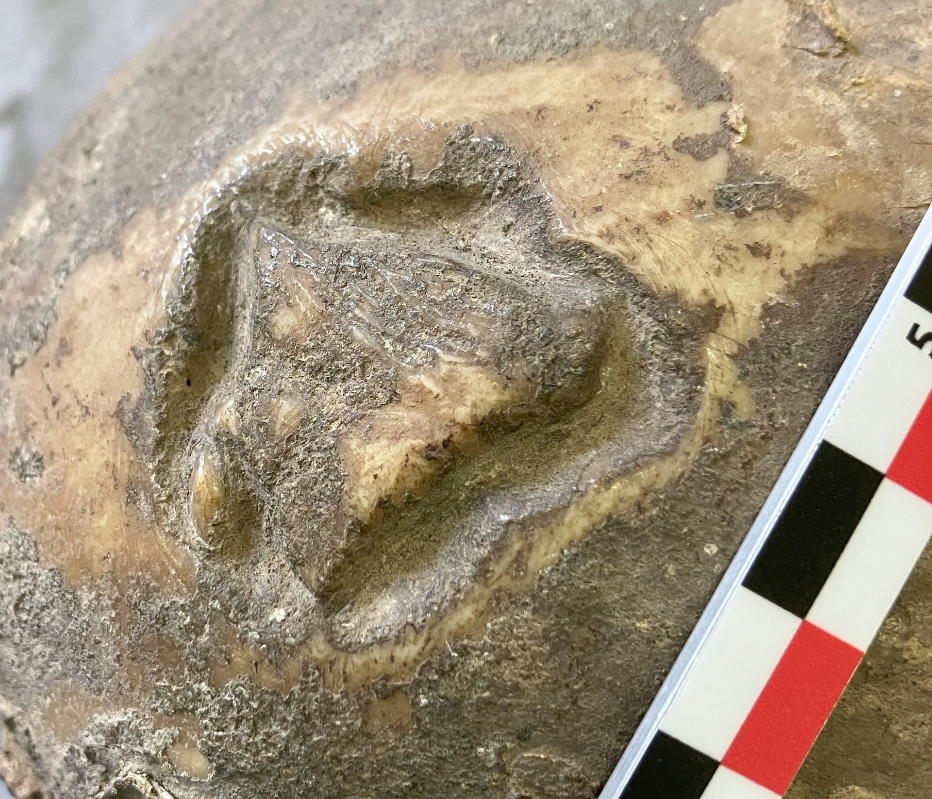a close-up of a lesion on the skull