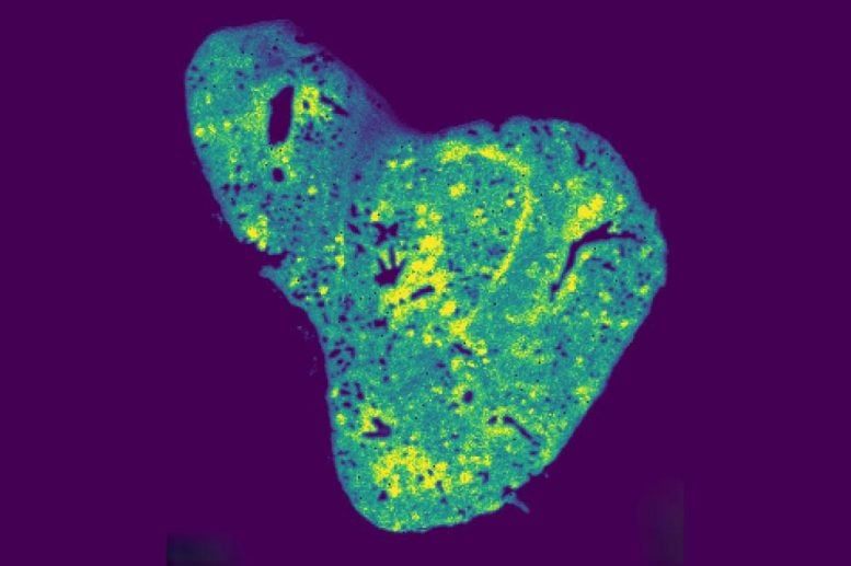 Spatial Metablomic Imaging of Glutathione