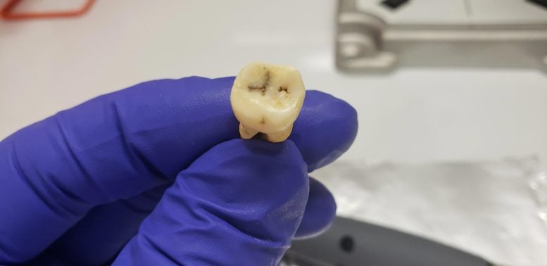 USF Researcher Holding Excavated Human Molar Tooth