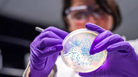 Getty Images A female scientist wearing purple gloves examines a petri dish container e.coli.