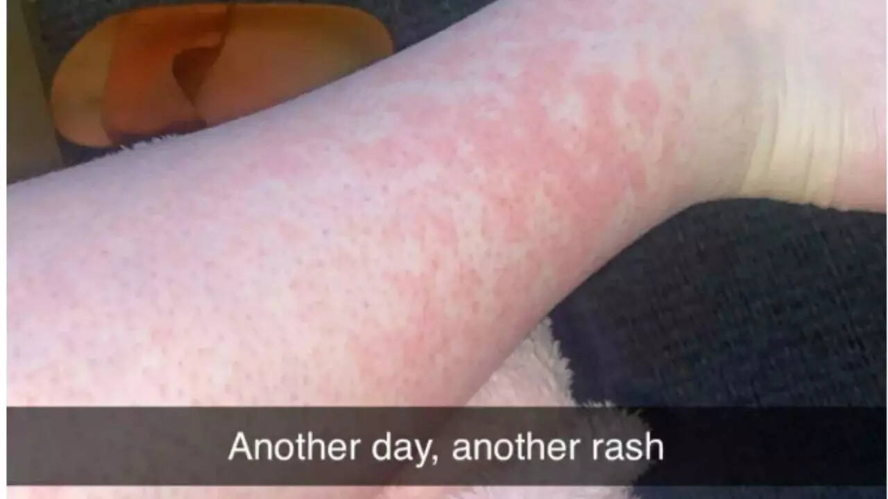 Source: The Sun Amber’s early warning signs misunderstood which lead to fatal CML