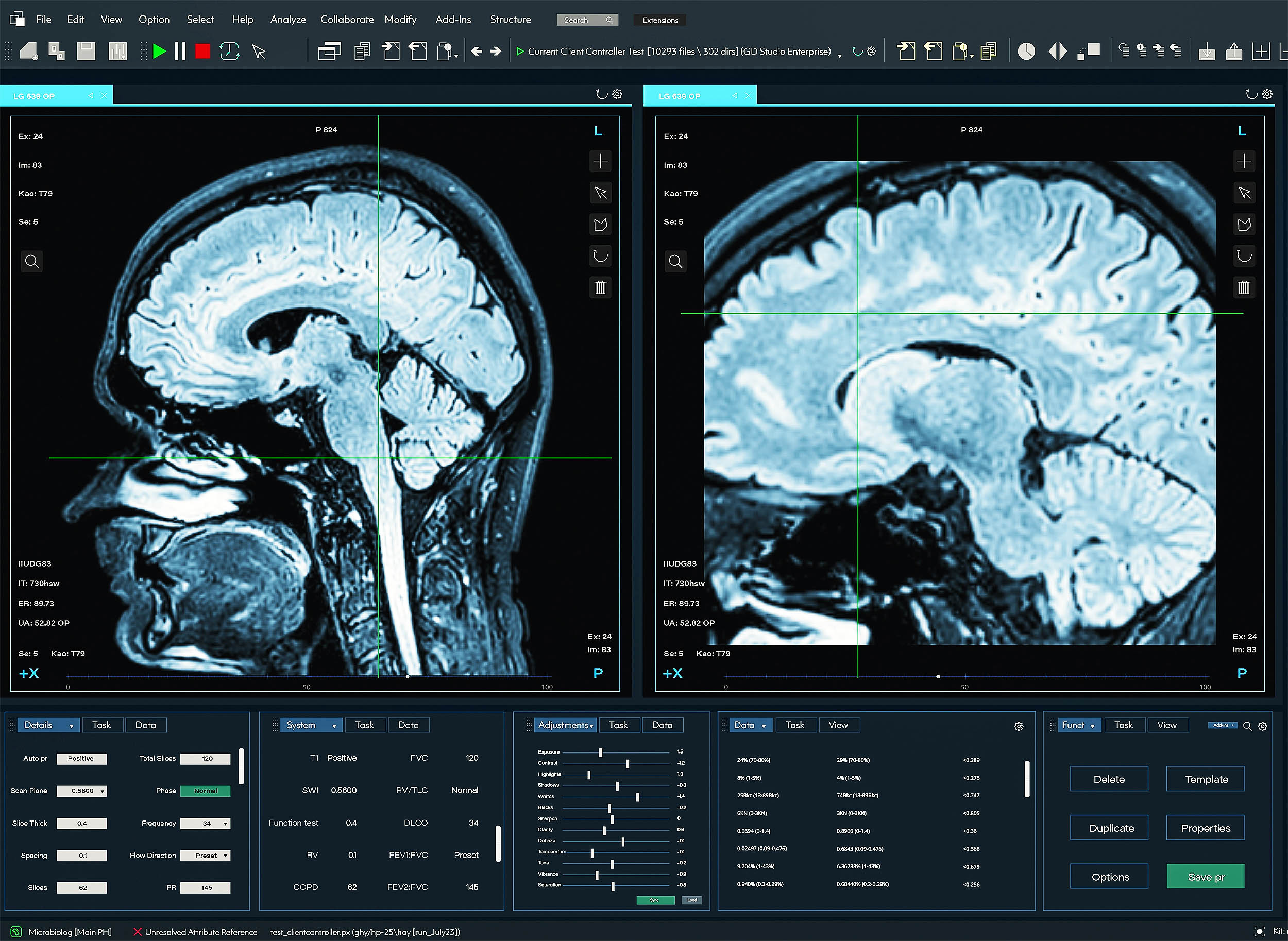 Very specific ages identified when our brains lose cognitive control