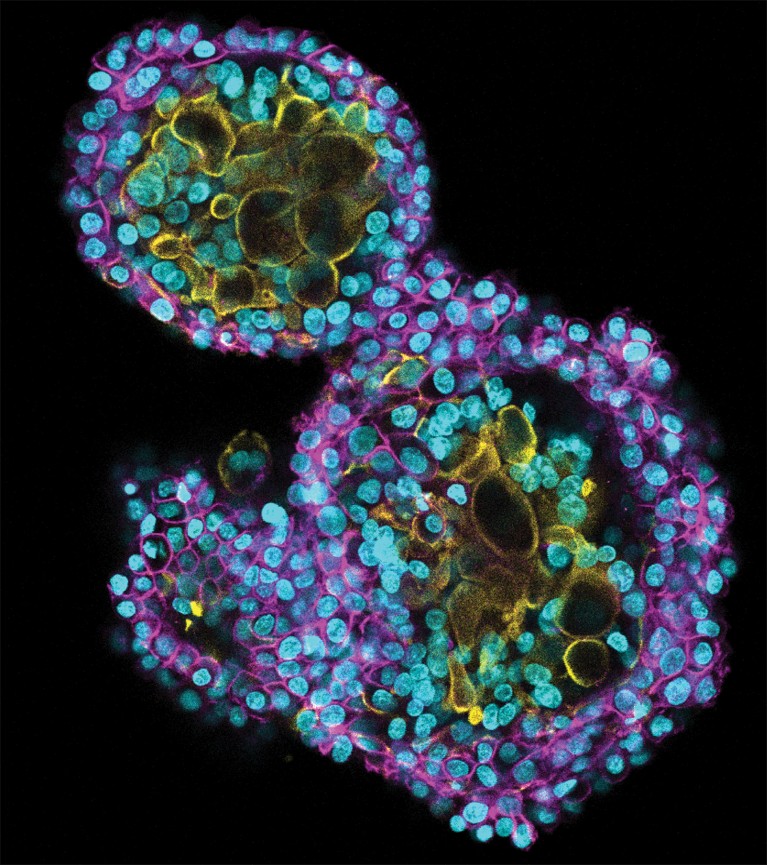 Micrograph showing blue and purple cells in a rough figure 8, surrounding blue, green and yellow cells