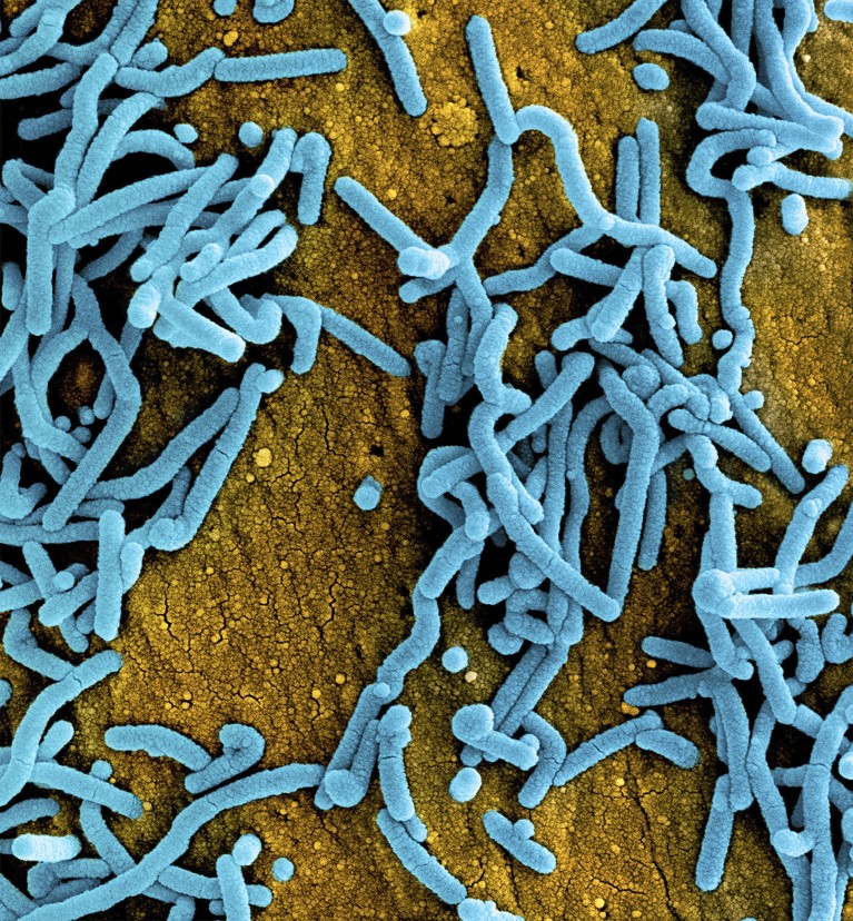 A coloured scanning electron micrograph (SEM) of the Marburg virus.