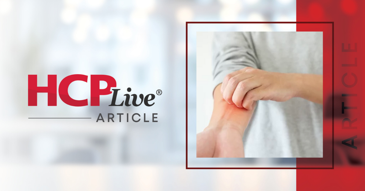 Safety, Efficacy of Venom Immunotherapy Confirmed for Pediatric Patients